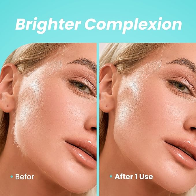 Sonic Dermaplaning Tool for Face - Rechargeable Dermaplane Razor with 6 Refill Dermablades, Facial Hair & Peach Fuzz Remover for Women (White)