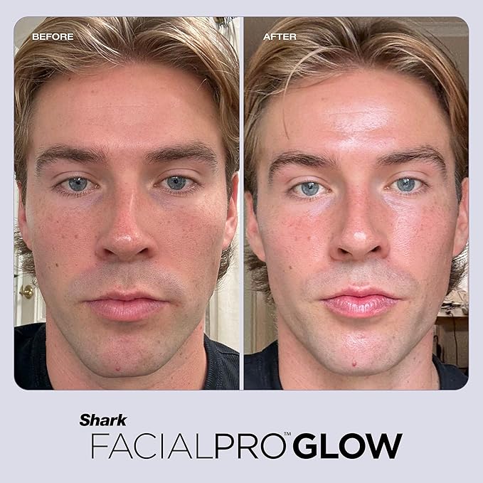 Shark FacialPro Glow at-Home Hydro-Powered Facial System with DePuffi Hot & Cold Therapy – Professional Spa Skincare Device for Pore Cleansing, Hydration, & Radiant Glow, Lilac, FH320PL