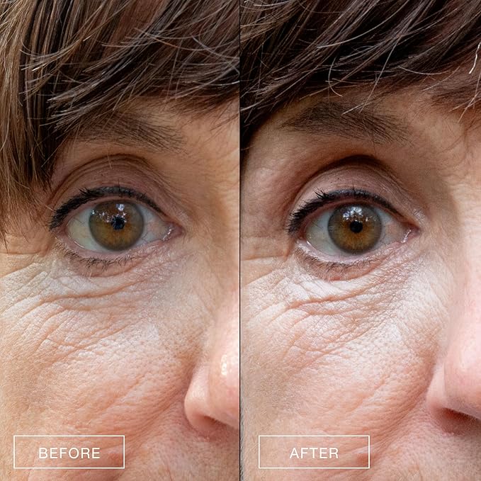 Boom Awaken Cooling Under Eye Cream - Targets Puffiness & Uneven Tone with Vitamin C, Licorice Root, Wild Mint, Green Tea & Hyaluronic Acid - Lightweight, Refreshing, Vegan Formula - 0.5 oz