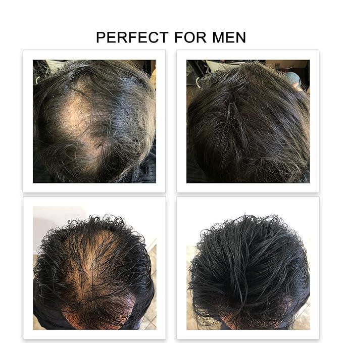 FEBRON Hair Fibers For Thinning Hair For Women & Men Hair Loss Concealer Hair Powder Volumizing Based 100% Undetectable & Natural - Bald Spots Filler (30 Gram, Dark Gray)