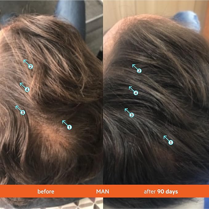 DS Labs Revita Conditioner, 205 mL – Scalp Refreshing Hydration for Fuller Looking, Weightless Hydration, Caffeine, Turmeric, Sulfate & Silicone Free, Color Safe, For Men & Women | High-Performance, Strengthening, Thickening, Volumizing, Fuller