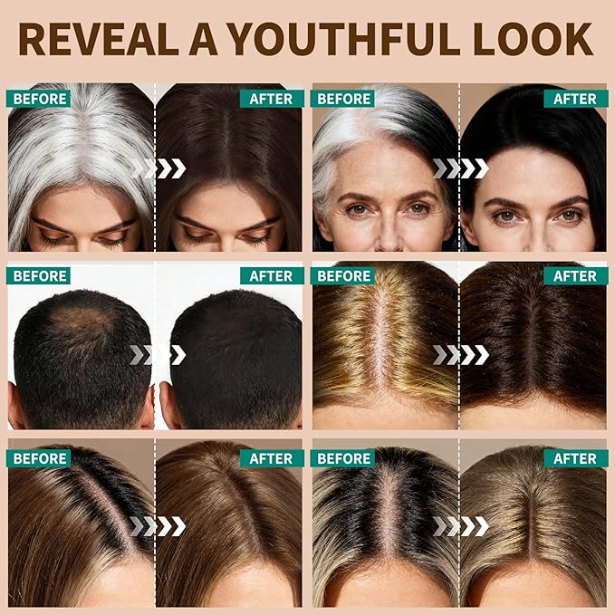 KIMUSE Hairline Powder, Root Touch Up Hair Color, Instantly Conceals Hair Loss, Bald Spot Thin Hair Powder with Dual-ended Hairline Brush for Women and Men, Transfer-proof & Sweat-proof