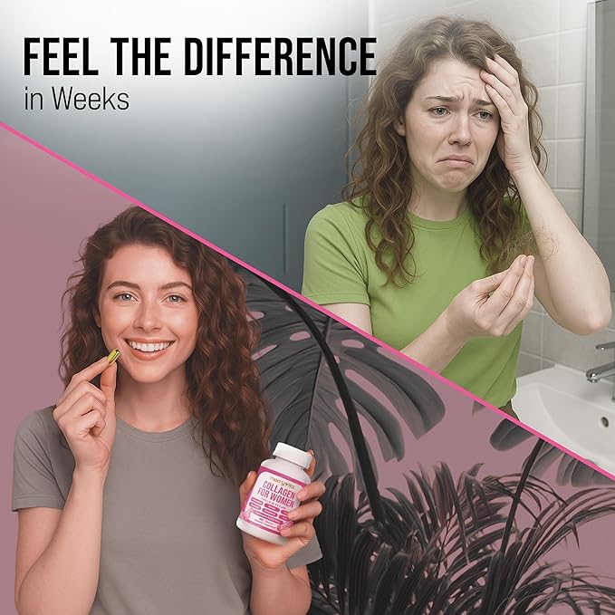 Collagen for Women – Hydrolyzed Multi Collagen Peptides Types I, II, III, V & X – Collagen Supplement with Vitamin C, Biotin & Hyaluronic Acid – Grass Fed, Non-GMO - 180 Capsules (Pack of 1 Bottle)