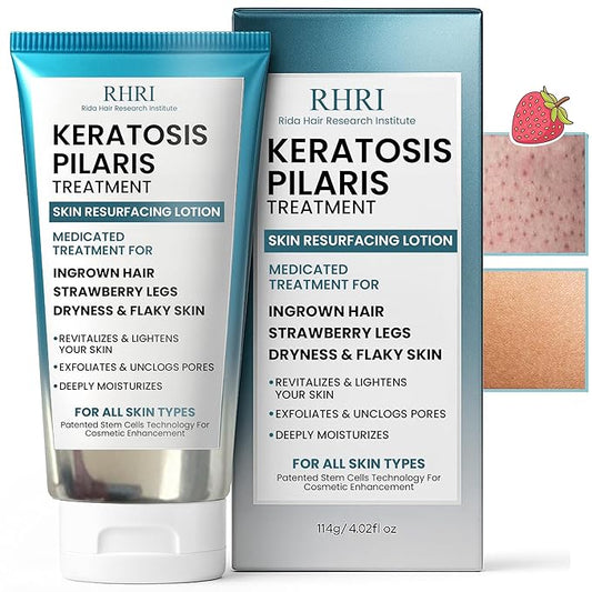 Keratosis Pilaris Treatment | Keratosis Pilaris Lotion with 10% AHA | Gentle Exfoliation For Strawberry Legs, KP & Ingrown Hairs | Smooth & Hydrating Body Lotion For Redness, Dry, Rough And Flaky Skin