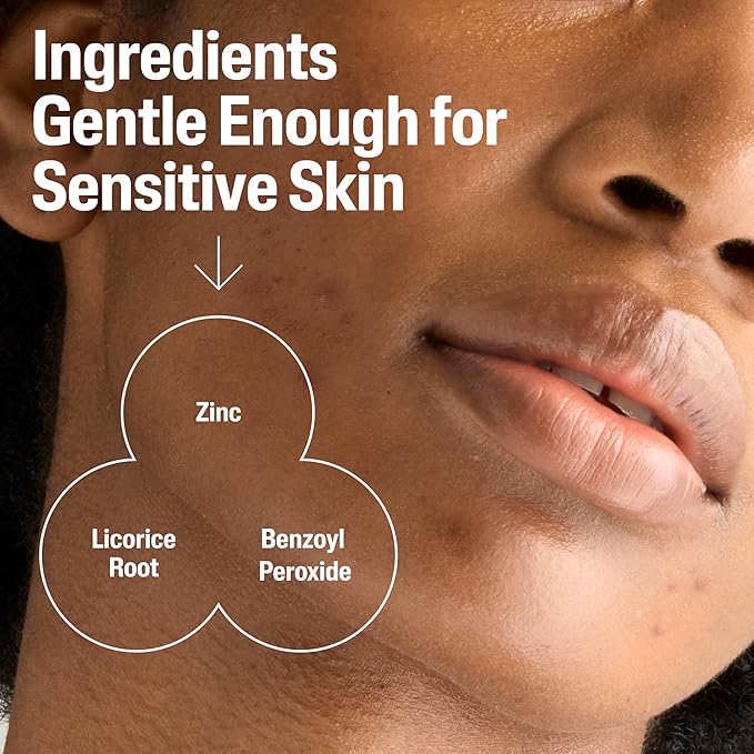 Cetaphil Gentle Clear Complexion-Clearing BPO Acne Cleanser with 2.6% Benzoyl Peroxide, Creamy and Soothing for Sensitive Skin, Suitable for All Skin Types, 4.2oz