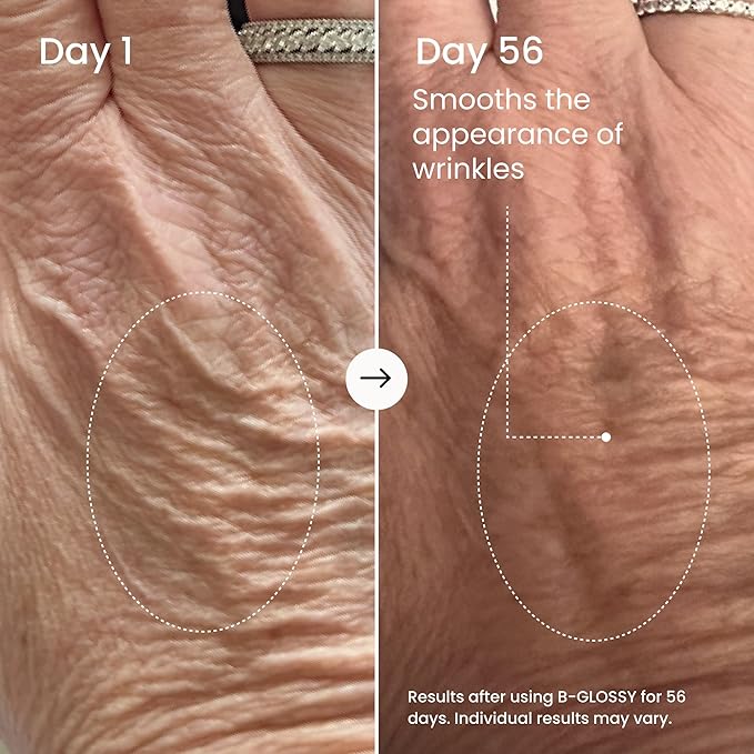 MAËLYS B-GLOSSY Smoothing Body Serum for Women - Hyaluronic Acid & Peptide Formula - Helps Reduce the Look of Wrinkles, Texture & Crepey Skin - Lightweight, Fast-Absorbing Anti-Aging Serum (2 Pack)