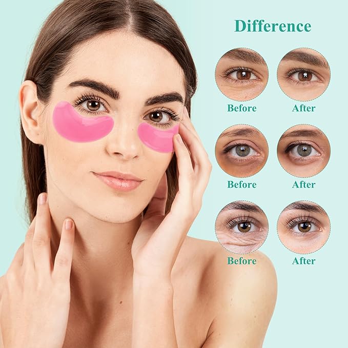 Under Eye Patches (30 Pairs), Under Eye Mask for Puffy Eyes, Dark Circles,Bags and Wrinkles with Collagen, Relieves Pressure and Reduces Wrinkles, 3Mix