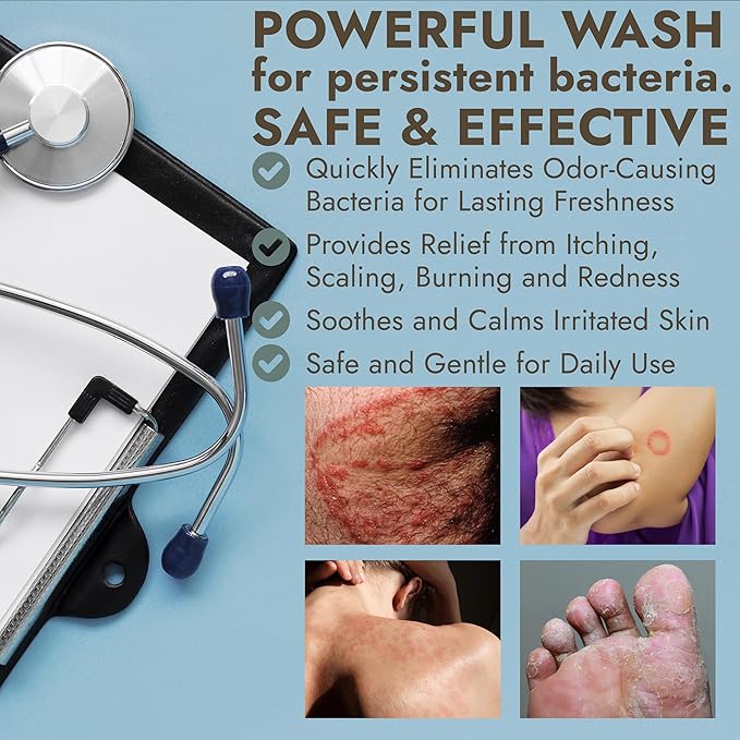 Antibacterial Body Wash | Antibacterial Soap for Men & Women | Kills 99.9% of Germs & Bacteria | Helps with Back Acne, Body Odor & Skin Irritation | Manuka Honey & Charcoal, 16 fl oz