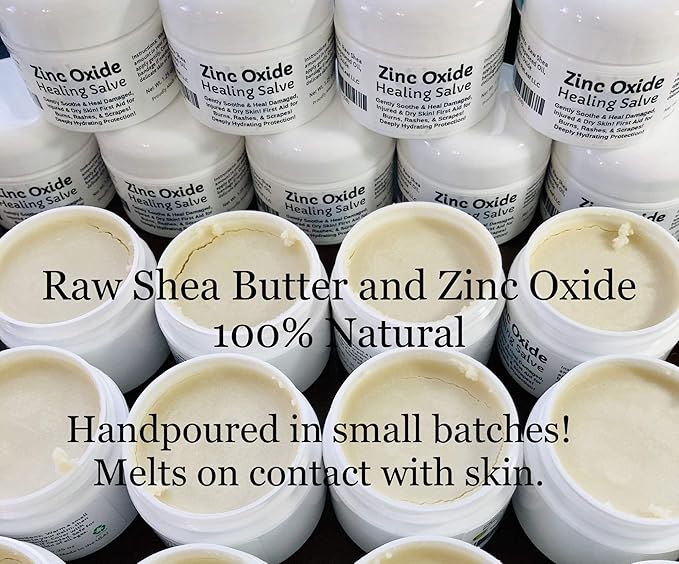 Urban ReLeaf Zinc Oxide Salve ! Gently Soothe & Protect Damaged, Injured & Dry Skin! First Aid, Burns, Rashes, Scrapes! Deeply Hydrating Protection. 100% Natural! Calm delicate skin of all ages.
