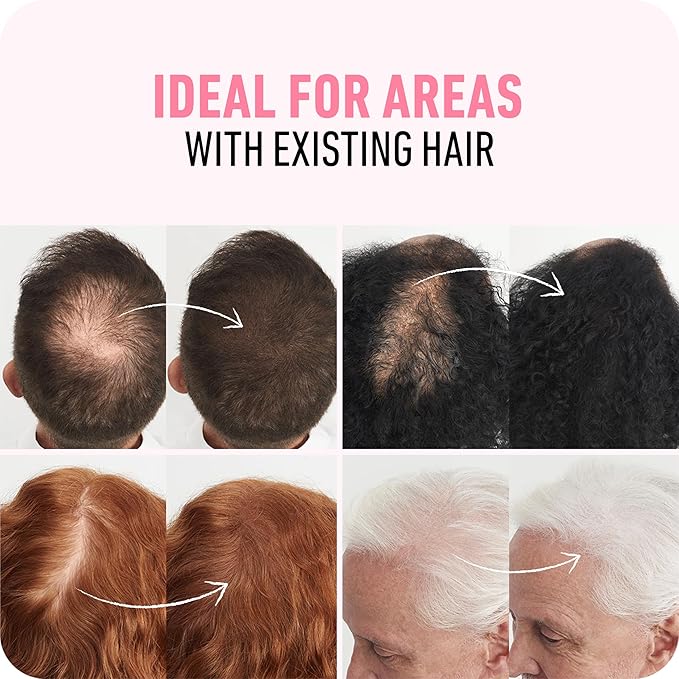 BOLDIFY Hair Fibers (56.5g) Fill In Fine and Thinning Hair for an Instantly Thicker & Fuller Look - Best Value & Superior Formula -14 Shades for Women & Men - Dark Blonde