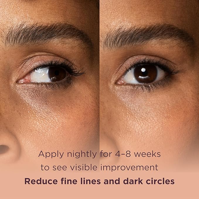 MATKAS Korean Retinol Under Eye Cream for Dark Circles & Puffiness 0.5 fl.oz. - Brightening Under Eyes Cream for Wrinkles & Anti Aging, Korean Under Eyes Brightener for Dark Circles, Retinol Eye Serum