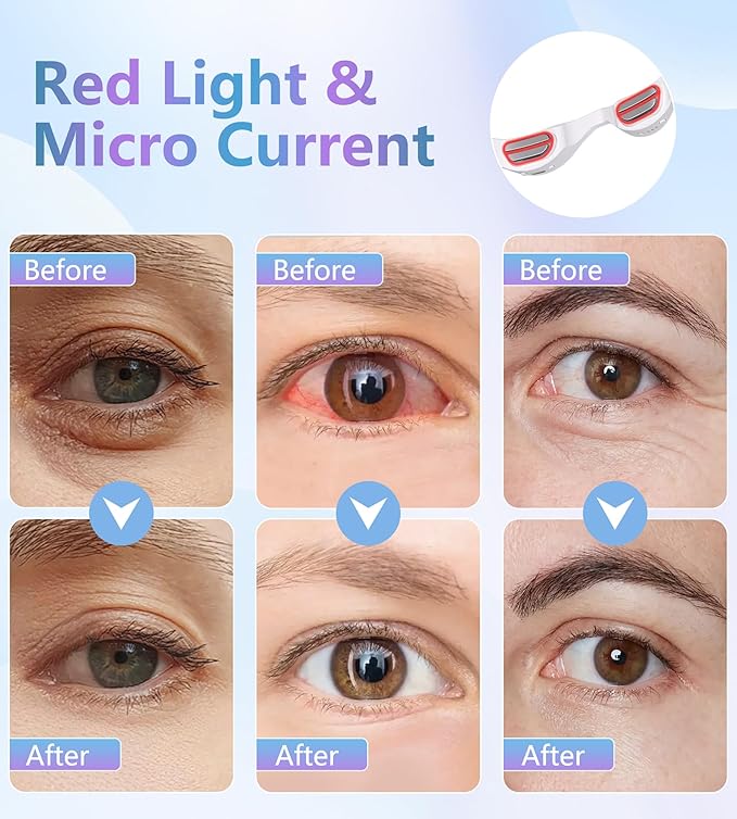 Under-Eye Red Light Therapy Glasses, Rechargeable Therapy Device Microcurrent Eye Massager, Botanique Paris Eyes Bag Remover for Dark Circles, Eye Bags & Wrinkles