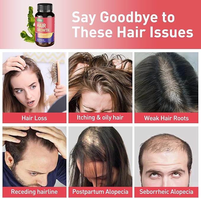 XKQ Hair Growth Supplements, Supports Hair Health & Fullness with Nutrient Replenishing Formula, for Men & Women Seeking Thicker-Looking, Healthier Hair – 2 Month Supply