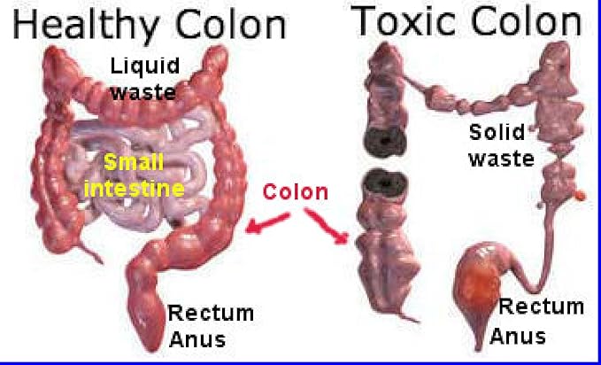 Miracle Oxy-Colon 2 Day Colon Cleanser and Detox - Total Body Cleanser - Intestinal Cleanser - Voted #1