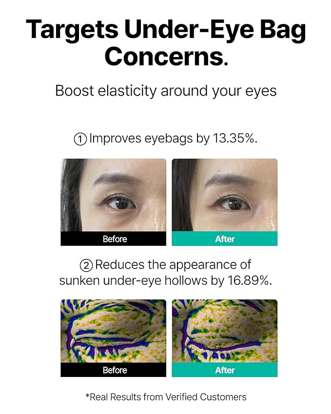 CHARDE Eye Bag Lift Patch with 1100 Dissolving Micropoints – Intensive Under-Eye Care to Help Smooth Tired, Puffy-Looking Eyes (4 Pairs)