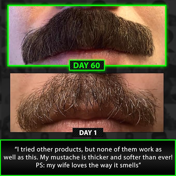 GROW Beard Growth Serum + 2X Biotin Beard Balm – Thickening Conditioner with Castor Oil & Meadowfoam – Fills Patches, Boosts Growth, Softens & Styles – For Thicker, Fuller Men's Facial Hair