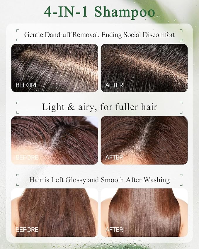 Mugwort Anti-Dandruff Scalp Care Set, Pre-Shampoo Scalp Serum with Brush & Oil-Control Shampoo, Oil-Control Refreshing formula, Soothes Itchy Scalp, Lightweight & Volumizing Hair