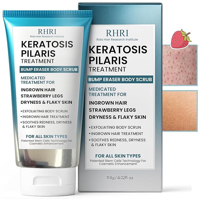 KP Bump Eraser Body Scrub with 10% AHA | Keratosis Pilaris Treatment | Bump Eraser Body Scrub | Ingrown Hair Treatment | Clears Strawberry Legs | Soothes Redness, Dryness & Flaky Skin
