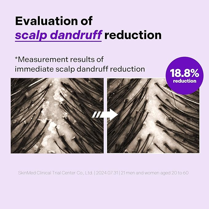 ALIVELAB O2 Scalp Water Shampoo for Sensitive Scalp, Itchy, Anti Dandruff, Deep Cleansing and Soothing, Hair Care, Scalp cleanser, Water Type, Liquid shampoo, Silicone-Free 22 fl oz