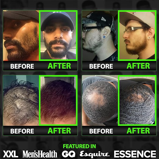 Biotin Beard Balm + 11-in-1 Beard & Hair Growth Shampoo – Kit with Castor Oil, Peppermint & Keratin – 2X Thickening Balm, Mustache Wax & Conditioner – Hydrates, Thickens & Softens