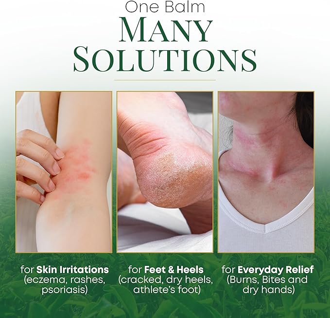 Tea Tree Oil Balm, Itchy Skin Relief for Soothing Rashes, Jock Itch, Athlete’s Foot, Folliculitis, Bug Bites. Natural Formula for Dry Sensitive Skin | Safe for All Ages 1pack