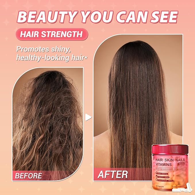 Kereeao Biotin Supplement for Hair, Skin and Nails - Support Healthy Hair Growth for Women & Men - Strong Nails & Radiant Skin - with Biotin, Hyaluronic Acid, Vitamin C, D3 & K2-120 Capsules (1 Pack)
