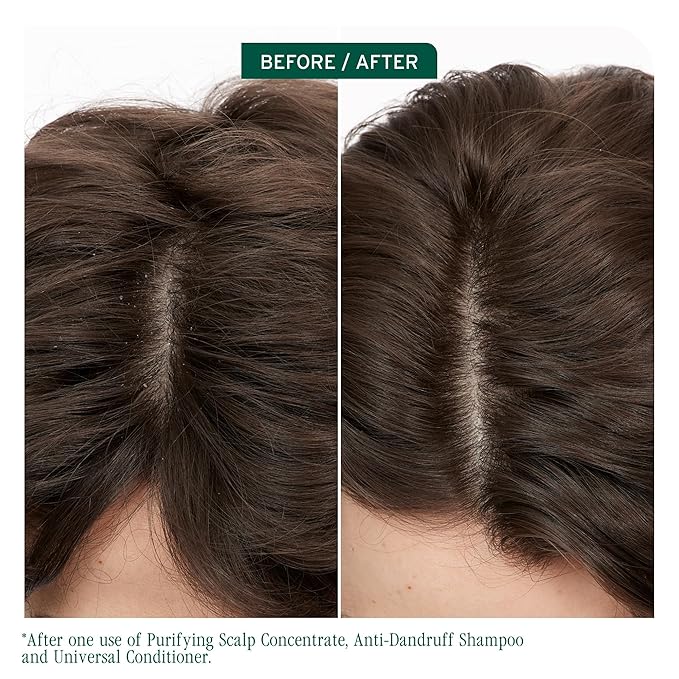 Biolage Scalp Sync Anti-Dandruff Shampoo - Controls Itchy Scalp, Deeply Cleanses Hair, Moisturizing Dandruff Treatment, With Zinc Pyrithione, Vegan & Cruelty-Free, 1.7 FL Oz