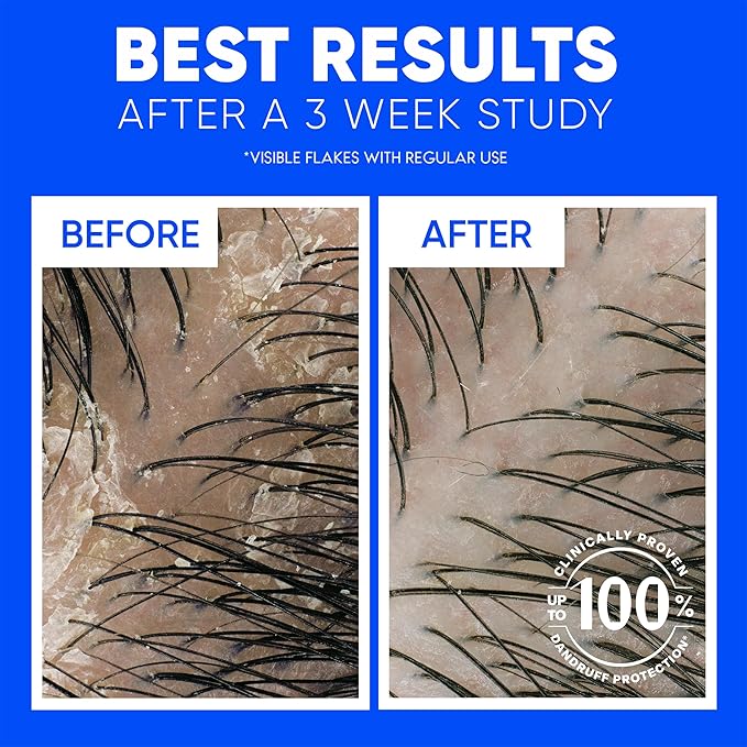 Head & Shoulders Anti-Dandruff Shampoo, Classic Clean Shampoo Twin Pack, 1% Pyrithione Zinc, Flake Control, Scalp Care, Color-Safe, Daily Use, Deep Clean, 32.1 fl oz Each